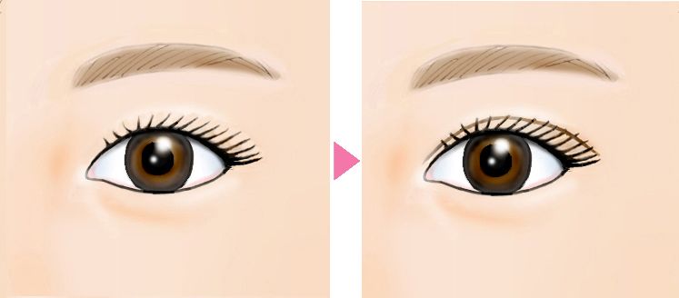 美容医療 施術イメージイラスト