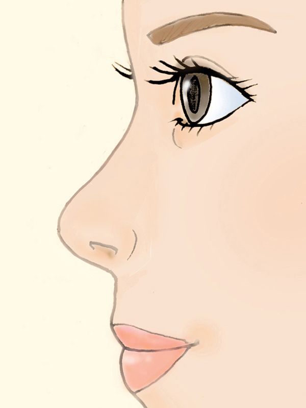 美容医療 施術イメージイラスト